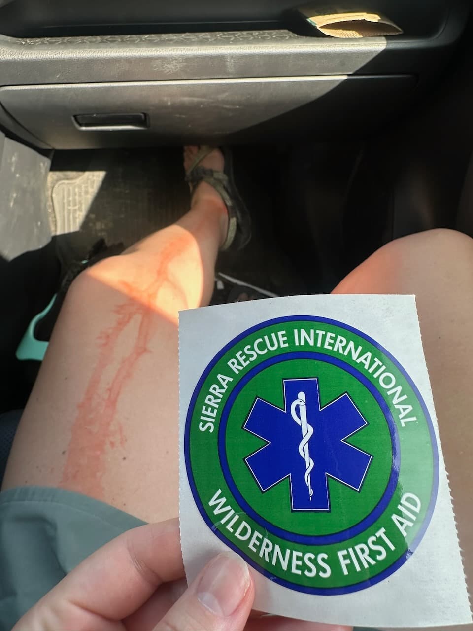 Madison's leg was a "victim" during the renewal of our Wilderness First Aid certification in June